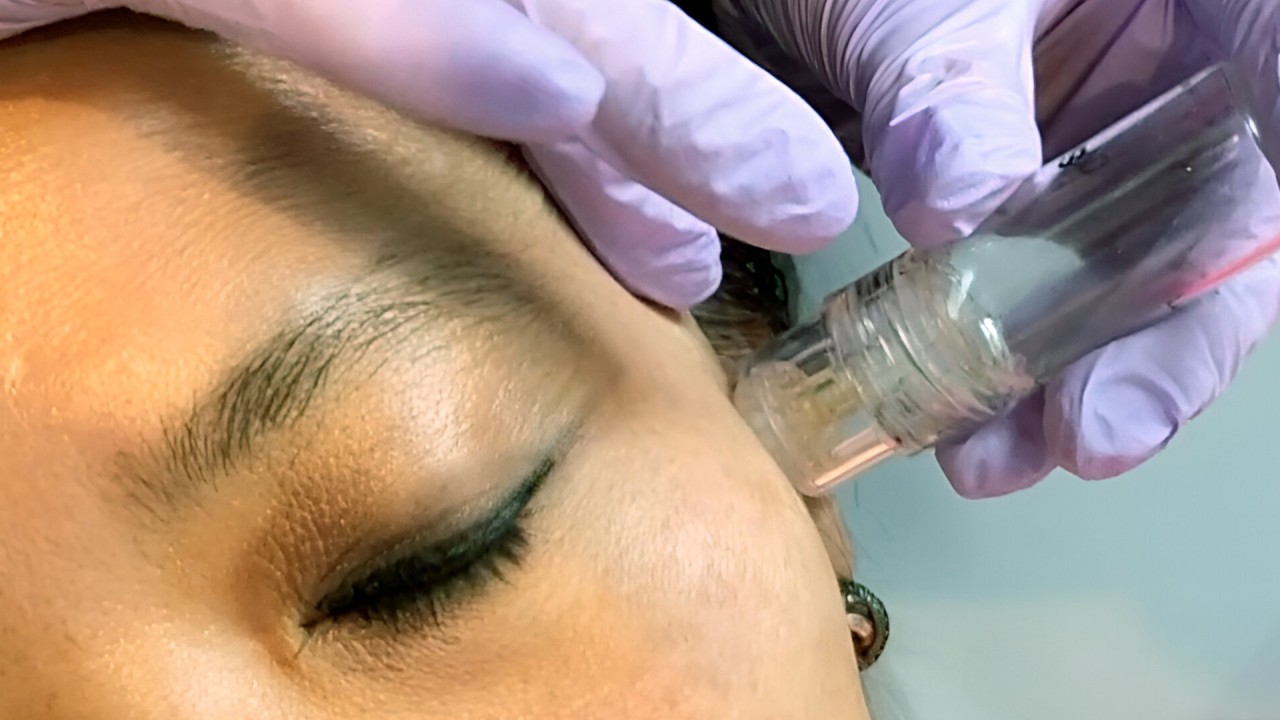 Dr. Elaine Chin, Founder, The Bespoke Wellness Group, first Cellf Rx™ treatment in the world on November 20, 2024