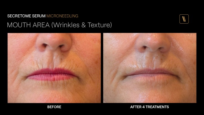 The Bespoke Wellness Group Cellf Rx™ Program to revive skin
